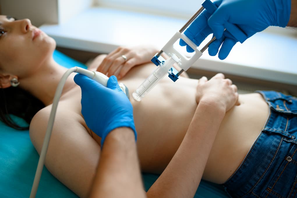 Ultrassonografia da mama